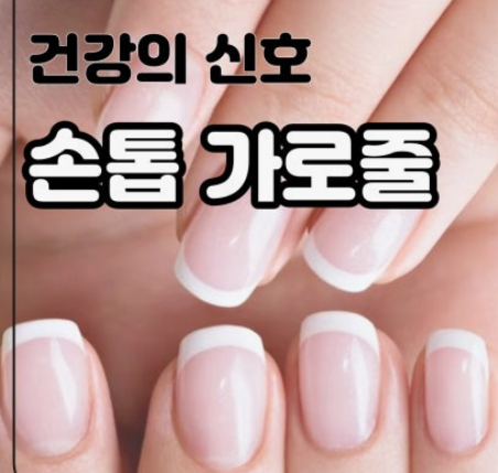  손톱가로줄 파임의 원인 , 건강 신호일 수도 있는 손톱의 변화