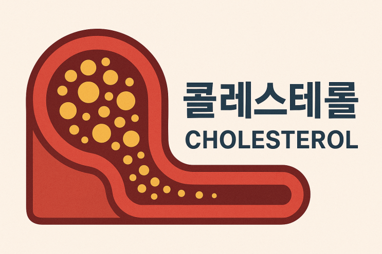  콜레스테롤 수치, 커피는? 낮추는 음식 TOP7