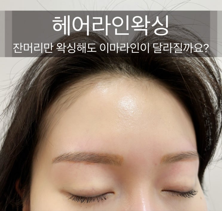  헤어라인왁싱 셀카 찍을 때마다 인생 샷