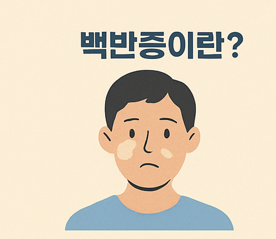 얼굴에 하얀 반점이 생겼나요? 백반증 초기 증상과 치료법 정리