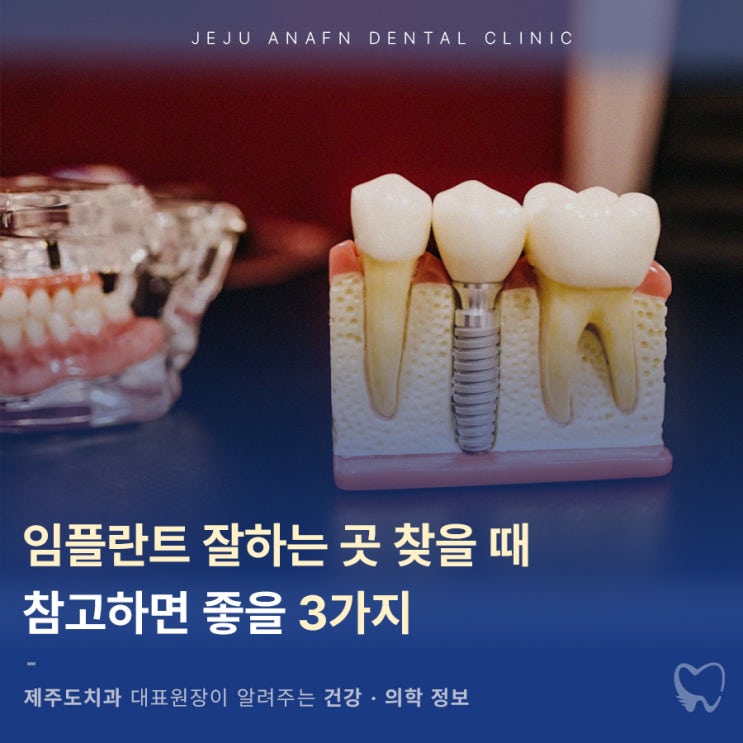  제주도임플란트 잘하는곳 찾을 때 참고하면 좋을 3가지