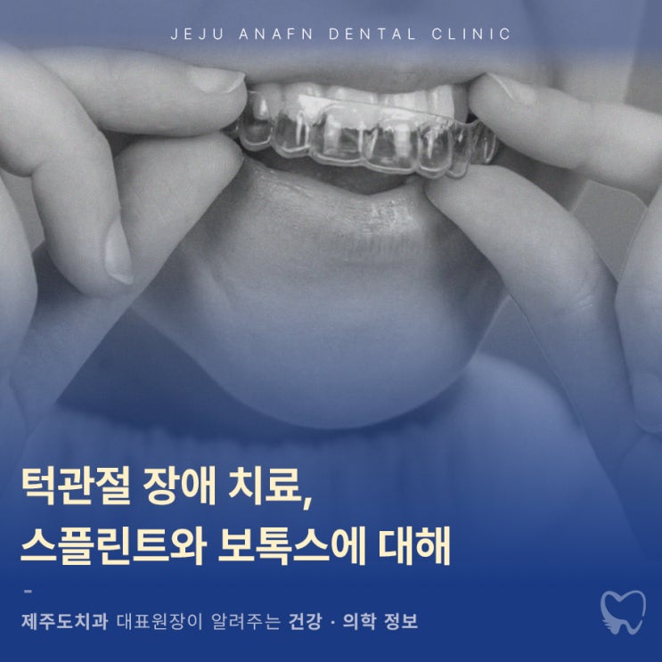  제주턱관절치료 스플린트와 보톡스 같이 하는 이유는