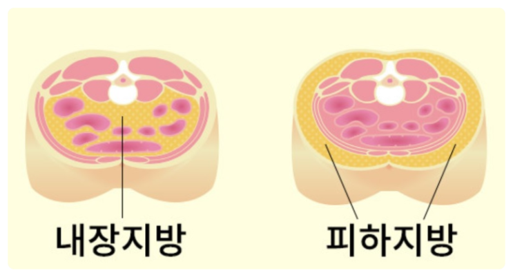  피하지방 뜻과 빼는법 빼는 운동까지 알아보니