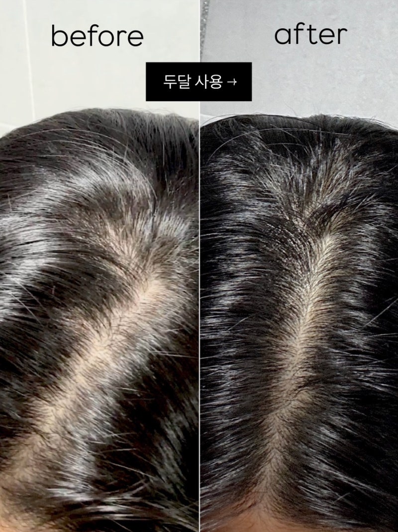 맥주효모샴푸 내돈내산 바이아우어 두 달 사용 리얼후기