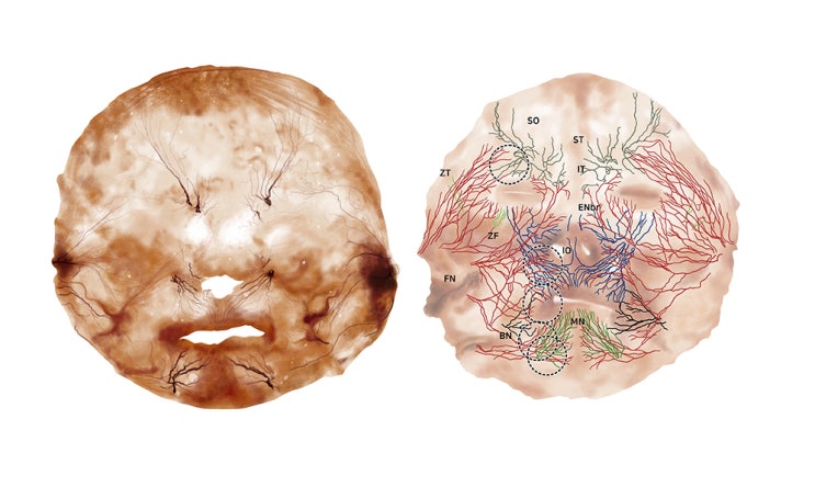  [Medical Illustration] 안면윤곽 수술 관련 해부학 일러스트 작업 – 구조의 층위를 시각화하다
