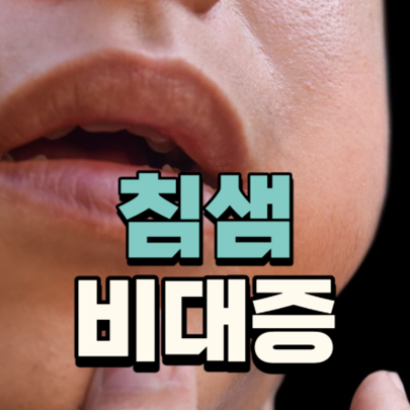 침샘 비대증 치료 방법 증상 원인 병원 선택
