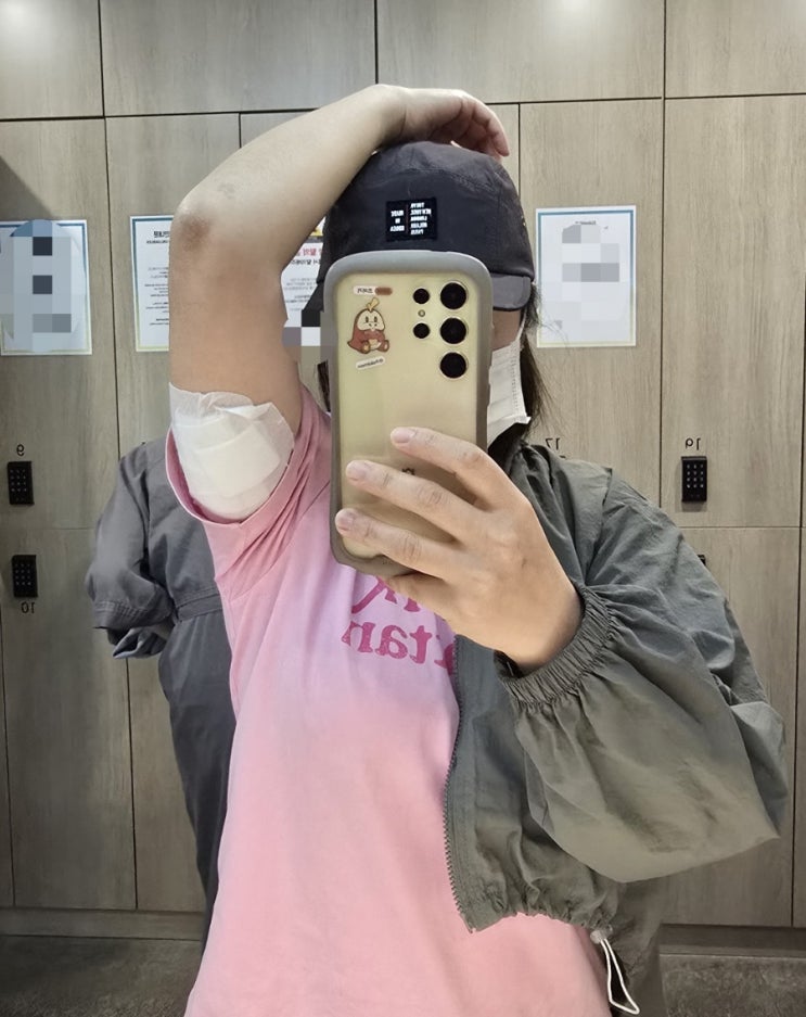  팔뚝 지방분해주사 부작용 통증 붓기 3회차 후기