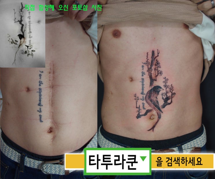  매화와 새 커버업타투/수술자국 바늘흉터 커버업/동양화스타일 [홍대 타투라쿤] 2017. 2. 27. 15:36