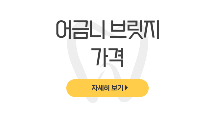  어금니 브릿지 가격 모르면 손해(수명, 교체비용, 단점, 앞니 치아 임플란트) - dentalist