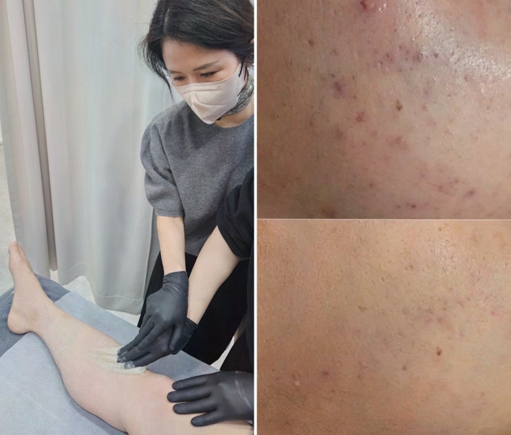  아비에 피부&왁싱 대전점에서 경험하는 완벽한 대전왁싱 서비스