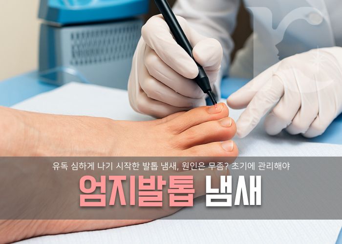  엄지발톱 냄새 심해졌다면 초기에 무좀 관리
