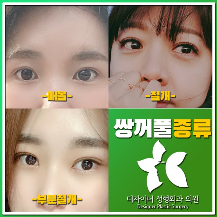  쌍꺼풀 종류를 쌍수 후기를 통해 쌍수 잘하는 곳 확인하기