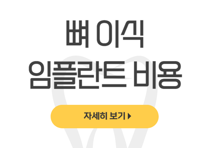  뼈 이식 임플란트 비용의 함정: 예상 밖 고액 지출 위험 경고 - dentalist