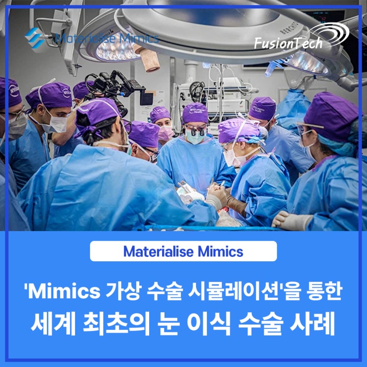  [Materialise S/W] 세계 최초의 눈 이식 수술, 그 뒤엔 'Mimics 가상 수술 시뮬레이션' 기술이 있었다