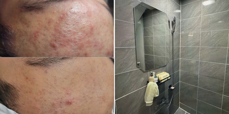  기념일에 아내와 함께 하는 특별한 대전피부관리