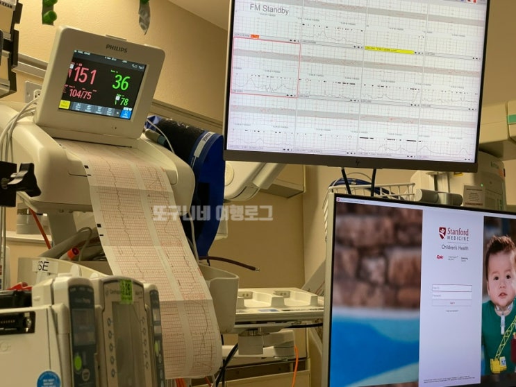  미국 출산 스탠포드 병원 유도 분만 후기 (2) Lucile Packard Children's Hospital Stanford