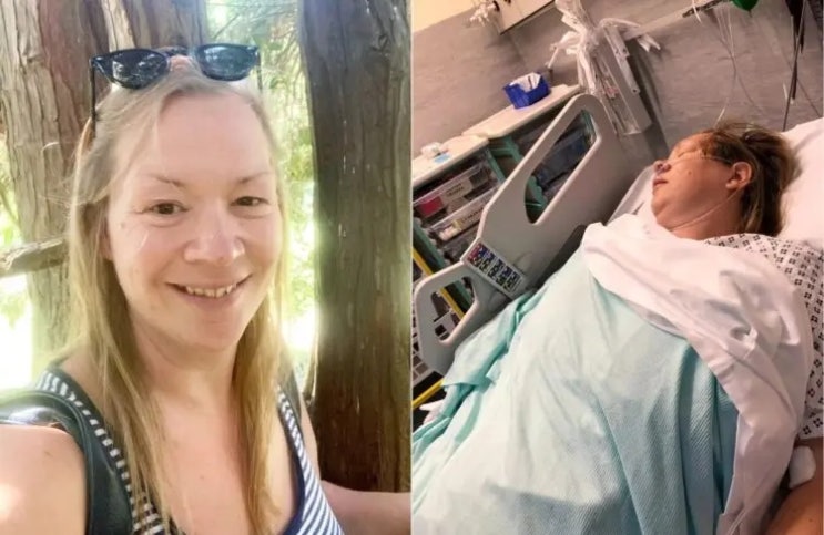 “말 어눌해지고 못 걸어”…‘이 동작’ 반복했다가 뇌졸중 걸린 40대女, 왜?
