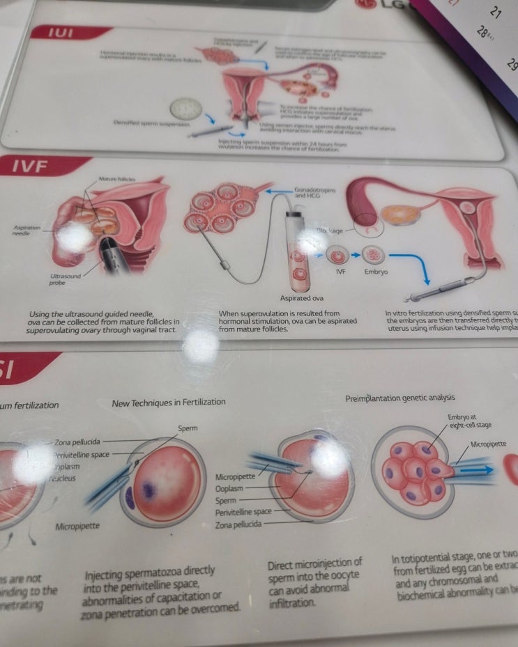 계류유산 후 재임신까지, 한약 복용 경험담 공유합니다