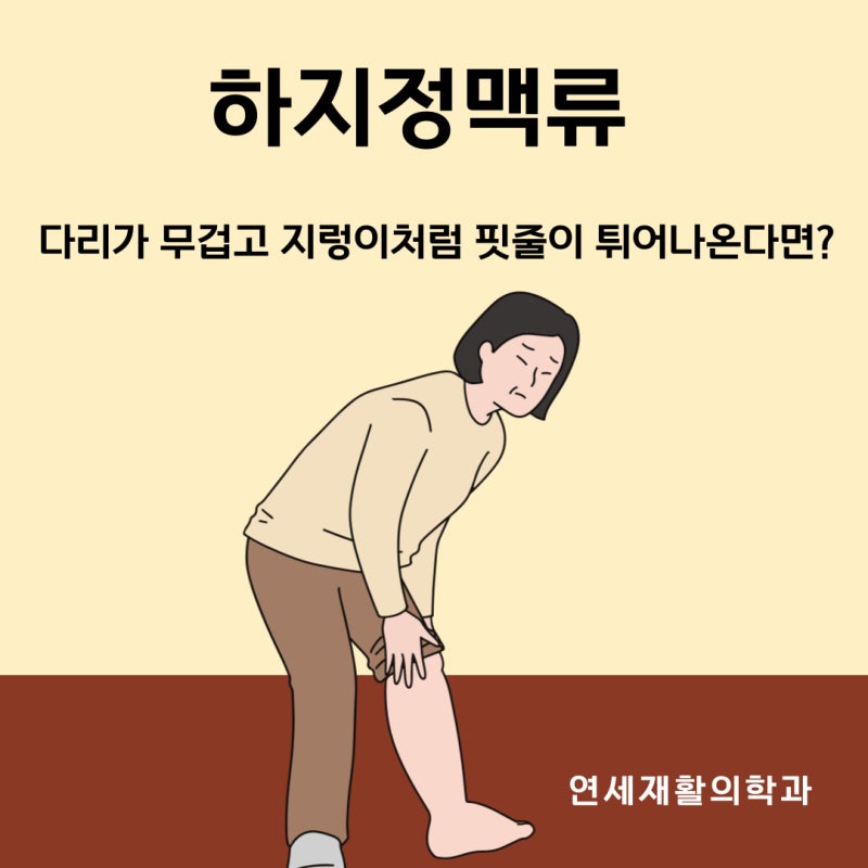 청주하지정맥류 병원, 단순한 다리 피로 아닌 정맥 순환 장애일 수 있습니다