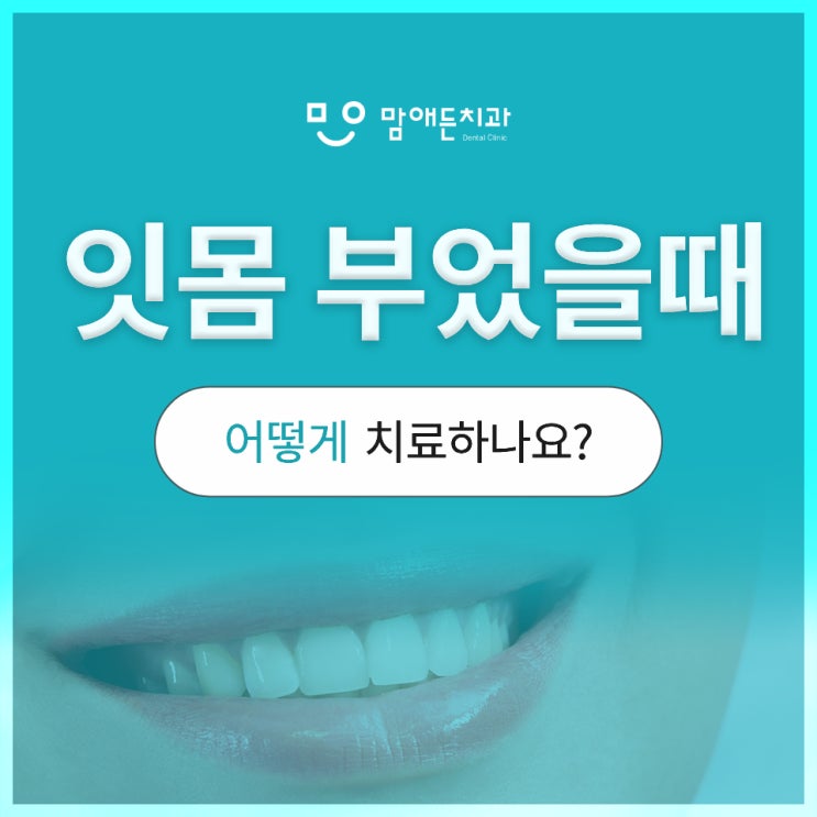  어금니 안쪽 잇몸 부었을때 걱정된다면?