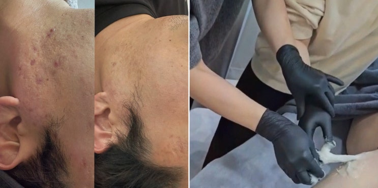  맞춤 케어로 만족스러운 대전피부관리, 아비에 피부&왁싱 대전점