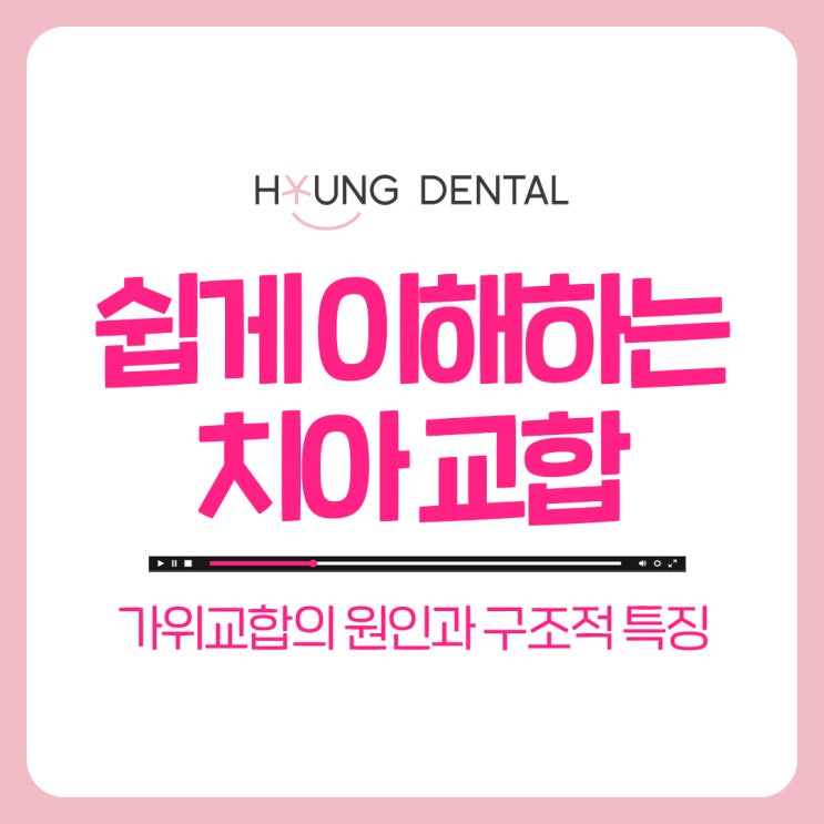 수원교정치과 가위교합 꼭 교정해야 할까?