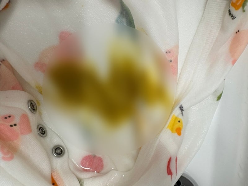 [육아] 아기 똥 묻은 옷 세탁법 지우는 법｜똥 얼룩 제거 순서와 꿀팁까지