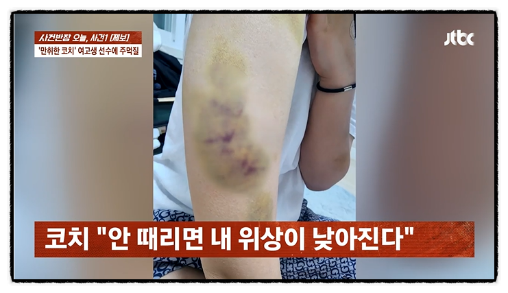  "기절 후에도 맞아" 서울 여고 태권도팀 L코치 상습 폭행, 학교서 은폐?