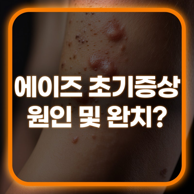 남자 에이즈 초기증상 걸리는 원인 및 완치여부