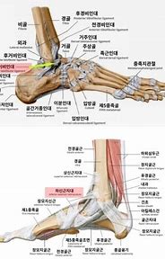 중족지골(MTP) 관절 염좌(엄지 발가락)