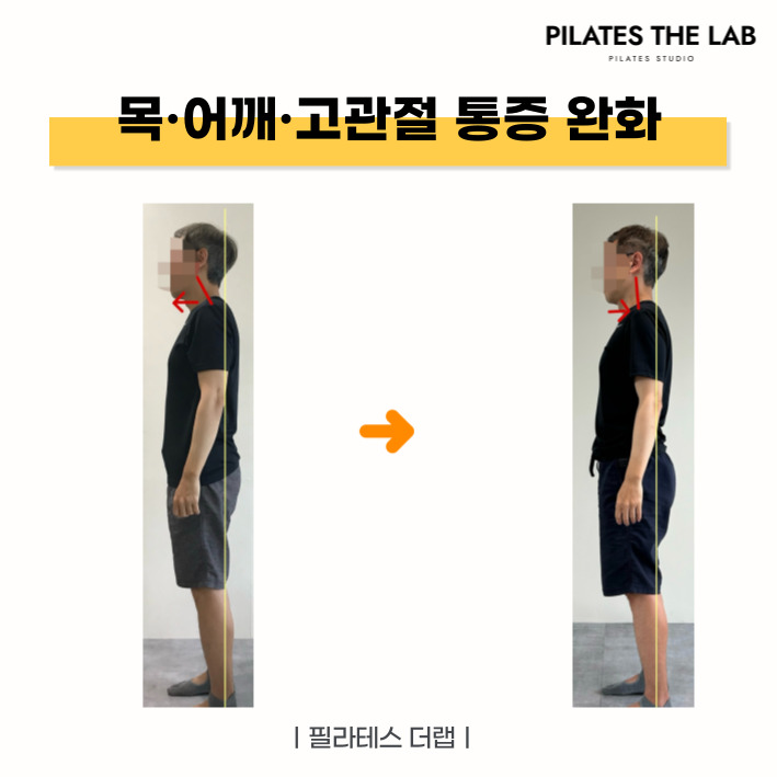  목·어깨·고관절 통증, 자세 문제에서 시작됩니다 - 목동 필라테스 체형교정 사례