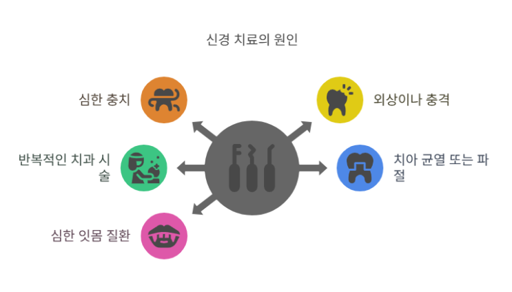  신경치료