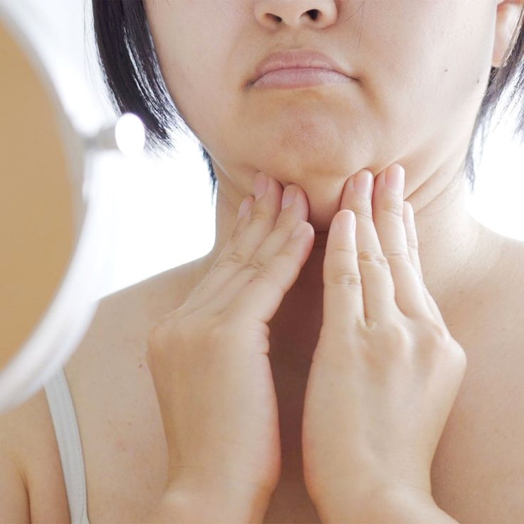  연신내울쎄라 리프팅, 턱선 무너졌다면 지금이 탄력 관리 시작할 때!