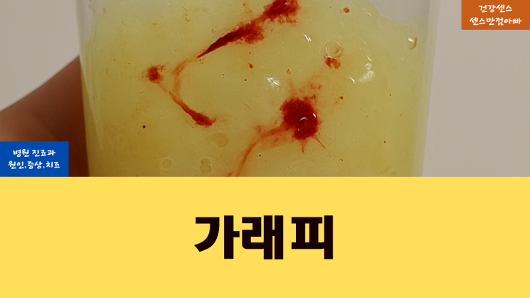 가래 피 병원 가야하는 이유와 진료과 원인 증상 및 치료