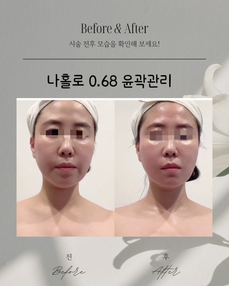  부산피부관리 나홀로 윤곽관리