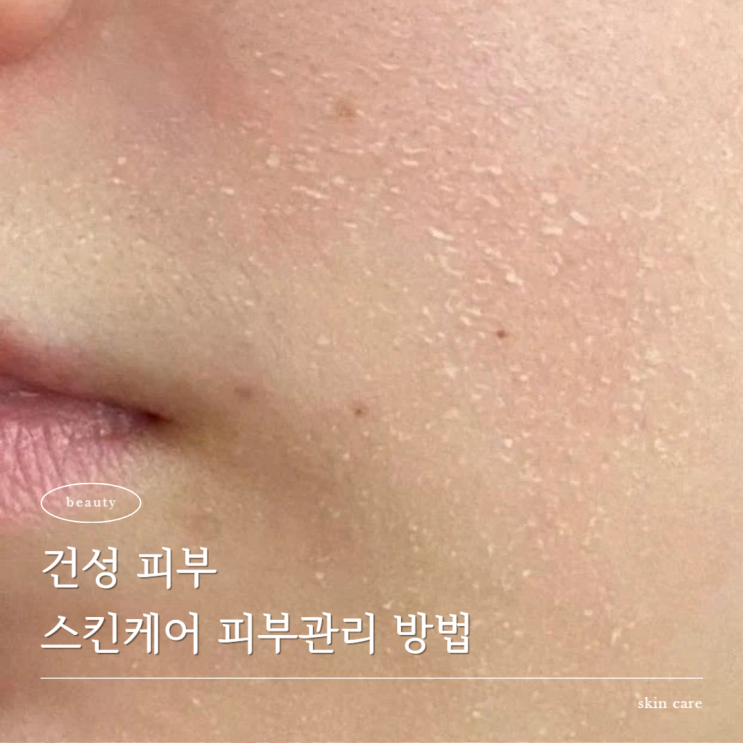  건성 뜻 건성피부 피부관리 방법 수분크림 추천