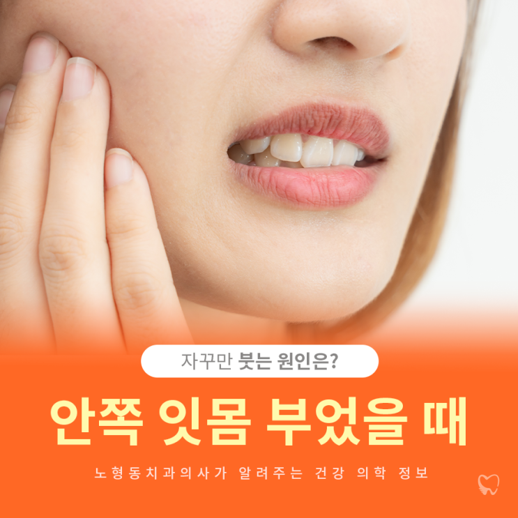  노형동잇몸치료 안쪽 부었을 때 체크해 보세요