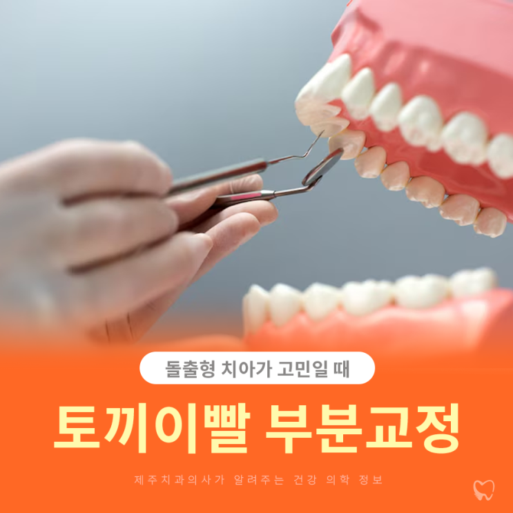  제주앞니교정 돌출형 토끼이빨 부분적으로 해결될까