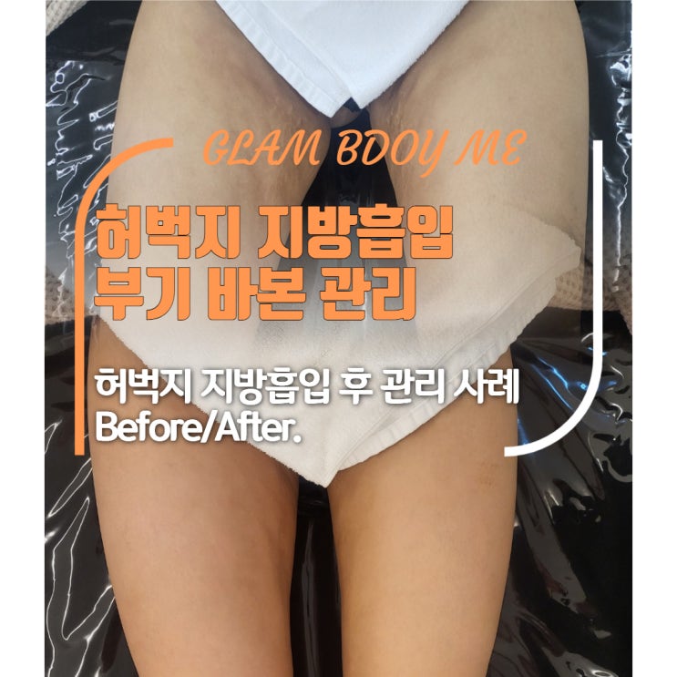  허벅지 바본관리 (2주 차 - 6주 차) B&A
