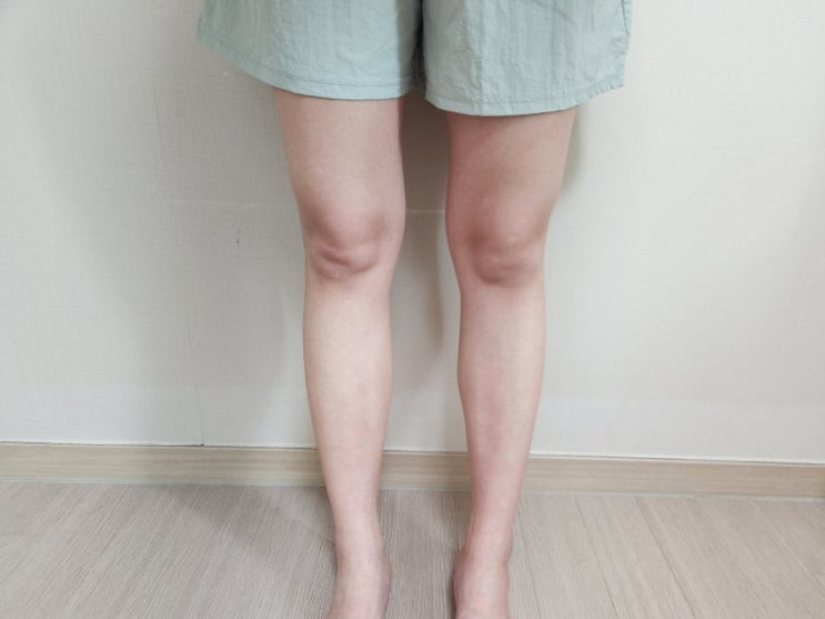  레그필 내돈내산 8주차 솔직 후기 – 하체 다이어트 내돈내산 변화 기록(-3cm)