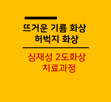 요리하다 뜨거운 기름에 화상입은 경우, 허벅지 화상, 심재성 2도화상 치료과정, 서울 강남 ....