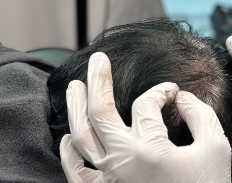  부산두피문신 가격 알고 싶다면 채움 그리다 'SMP로 풍성함과 자연스러움을'