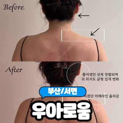  [부산/서면] 체형교정과 다이어트에 효과좋은 더조각 체형관리 "우아로움 부산서면점" 내돈내산