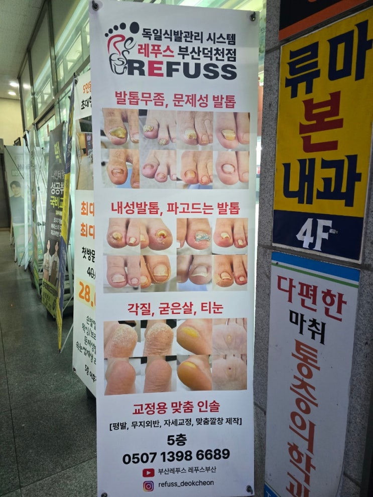 발바닥각질 부산레푸스 덕천점에서 해결했어요 굳은살관리