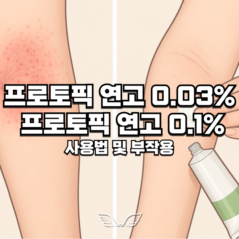 프로토픽연고0.1% 0.03% 사용시 주의사항 부작용 아토피 장기사용 가능?