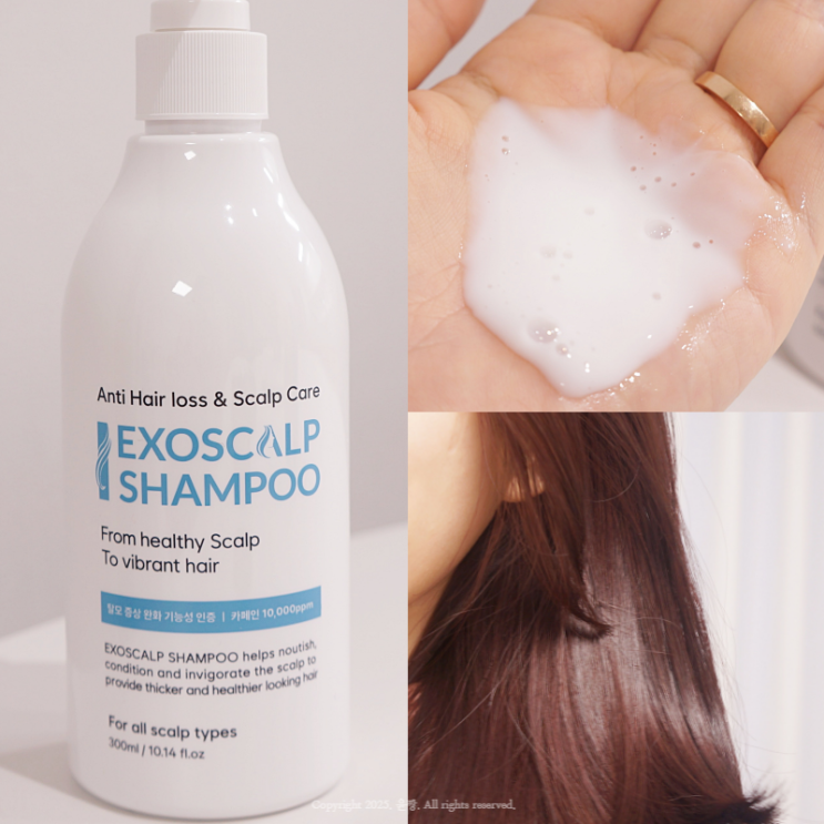  검은콩 탈모샴푸로 두피 냄새 잡고 머리숱도 챙긴 엠디셀 엑소스칼프 샴푸 사용후기