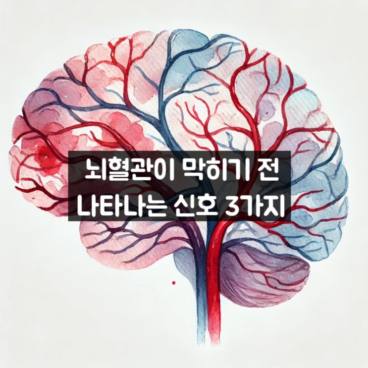  뇌혈관이 막히기 전 나타나는 신호 3가지