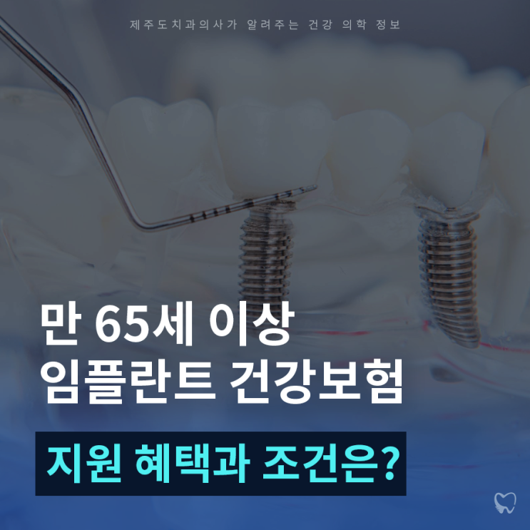  노형동임플란트 65세이상 건강보험으로 2개지원 가능