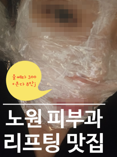  [노원역 피부과] 후기 울쎄라 300샷 온다 리프팅 8만줄 받고 얼굴선 되찾았어요