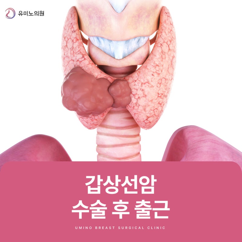 갑상선암 수술 후 출근은 언제부터 가능할까